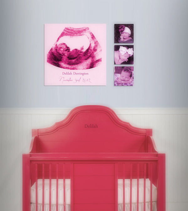 Custom Ultrasound Canvas - Canvas Vows